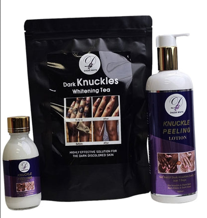 Dark Knuckles Solution Set