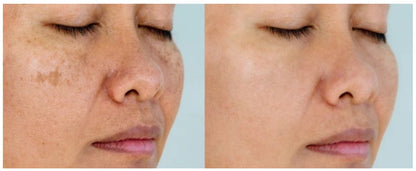 24K Gold Whitening Cream. Achieve smoother, brighter, and more hydrated, even-toned skin.
