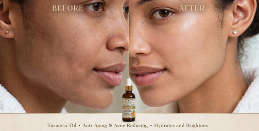 Turmeric Oil - Your Glow in a Bottle. Anti-Aging & Acne Reducing, Hydrates and Brightens!